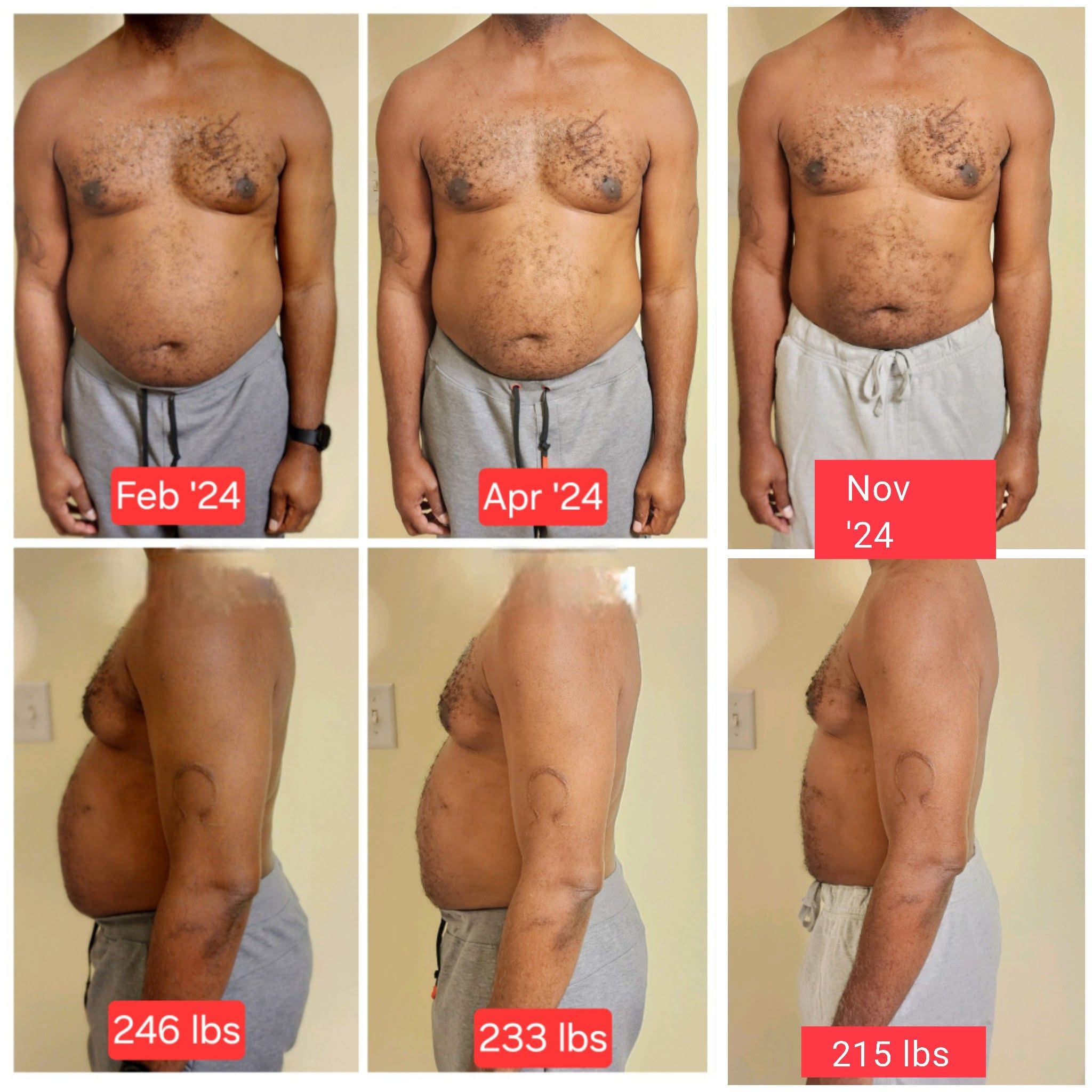 Johnny · belly before and after the Feel Great Protocol